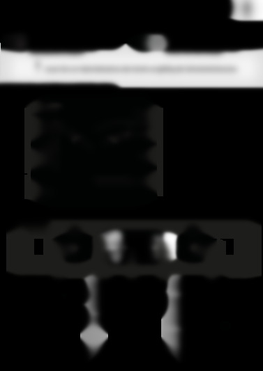 BAR2 KP8V2 IN