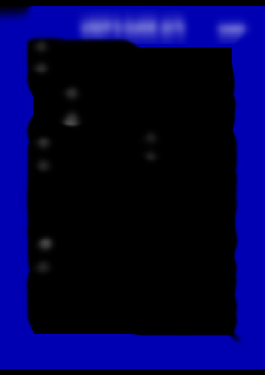 STR300