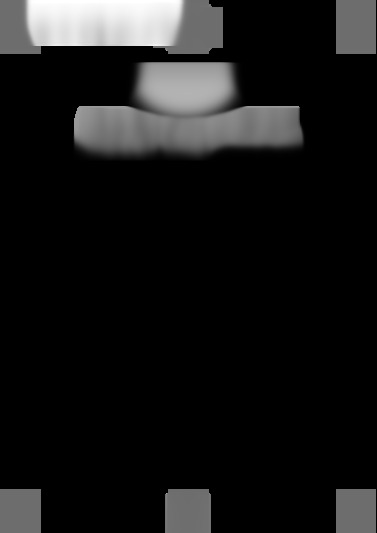 KOR-9PDK