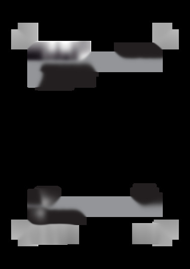 TC-RO 1155 E