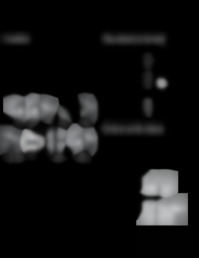 THR140-F