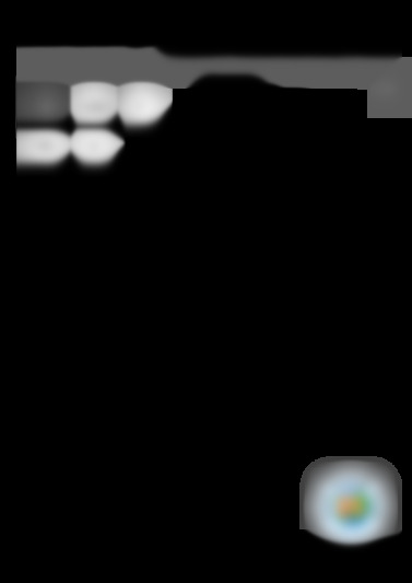 BAN 34 NF P