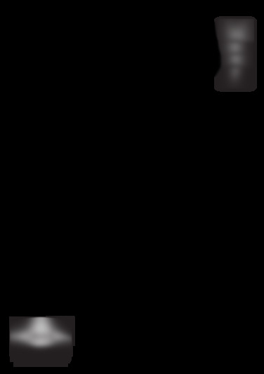 RENGORA
