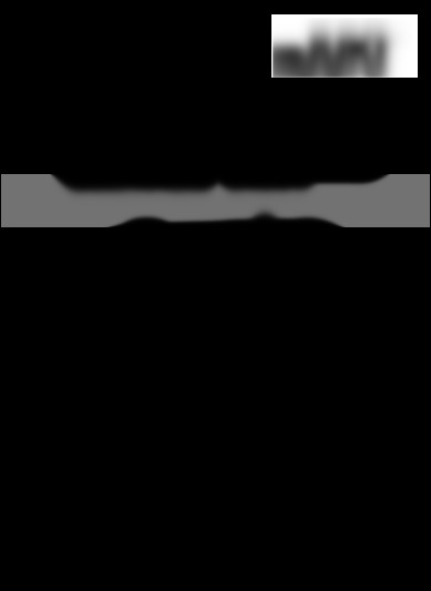 DNU-1541