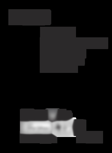 DPX305U