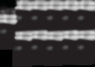 CSBTCARKIT100