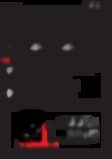 T31