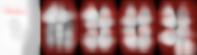 ovatio 3