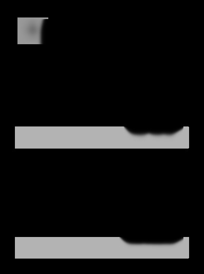 RLF 4912