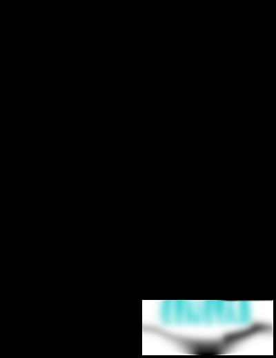 IntelliFiber