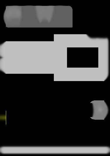 alf1202