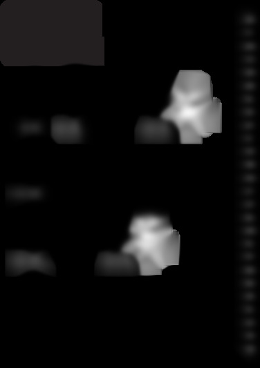 BXVC20PE