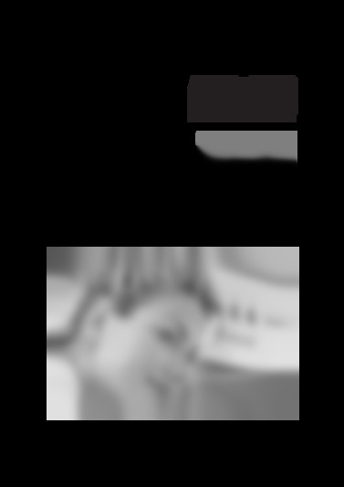 DFH133