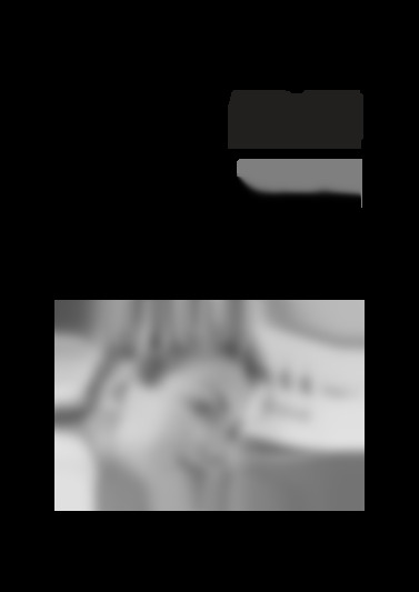 dfh726
