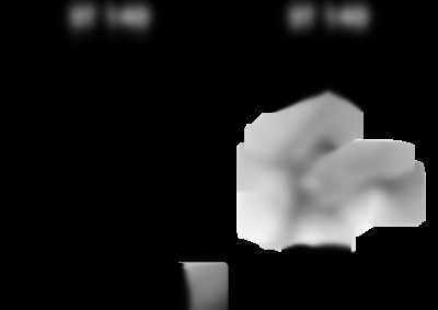 st140