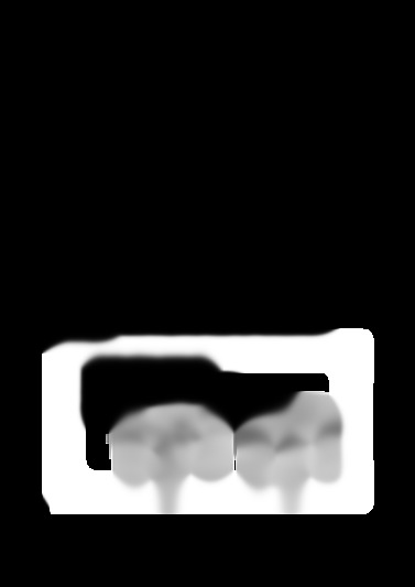 MFT/3