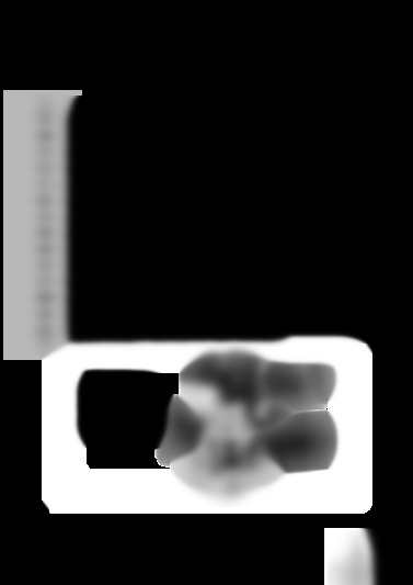 OF 1010