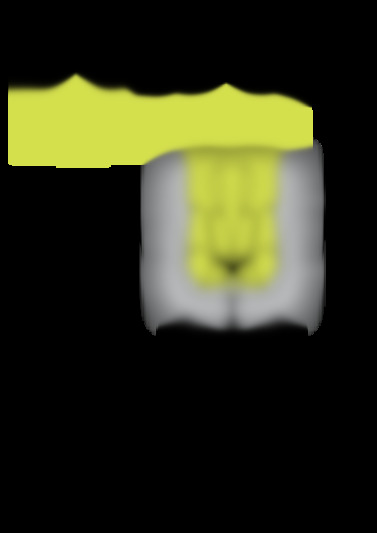 rebl