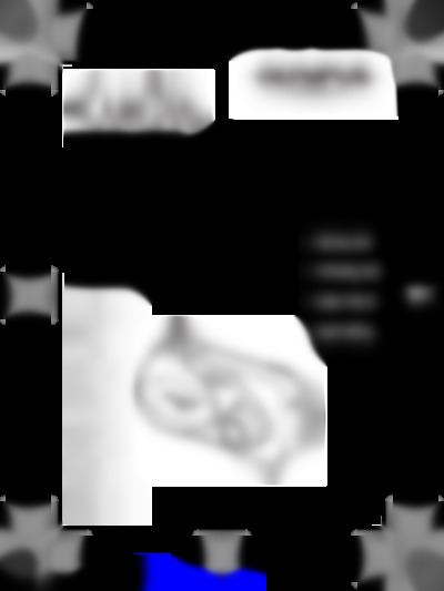 C-360 Zoom