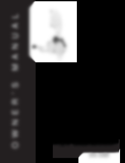 380