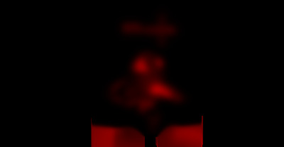 Éradicator cimex